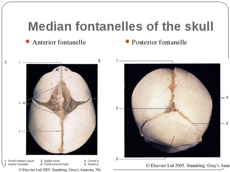 General Data About Cranium 3021