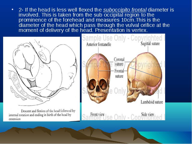 The Skull Divided Into The Vault Face And Base The Skull Divided Into The Vault Face And Base 3324