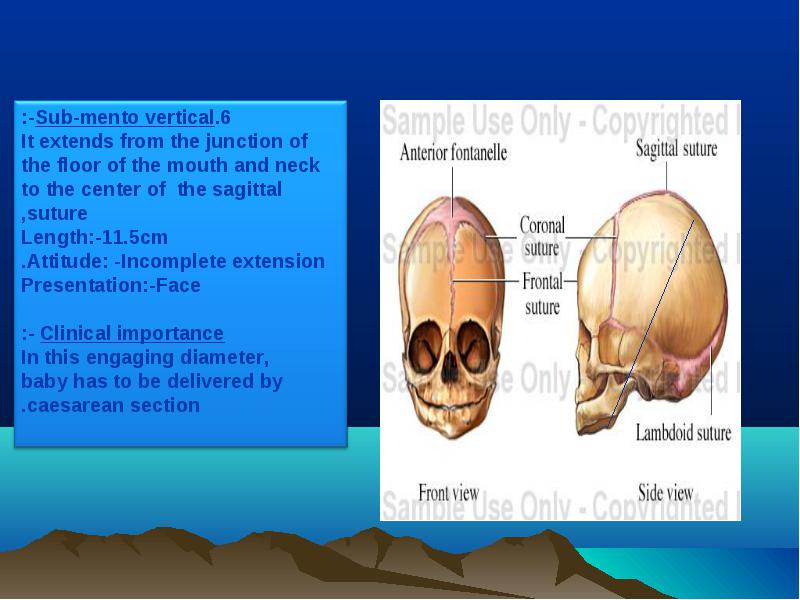 The Skull Divided Into The Vault Face And Base The Skull Divided Into The Vault Face And Base 7275