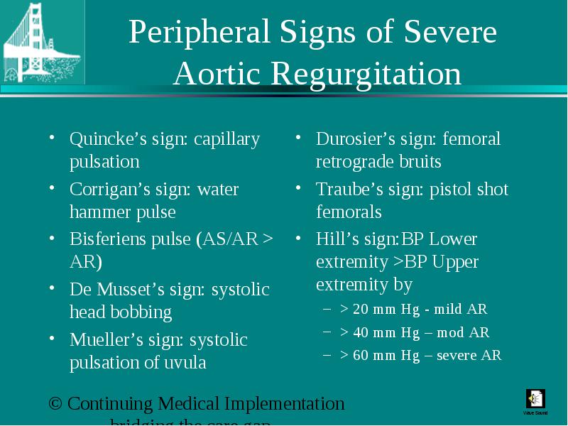 Valvular Heart Disease Aortic Regurgitation